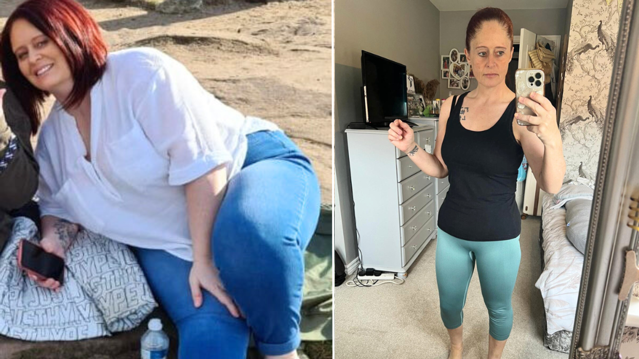 Woman before / after weight loss