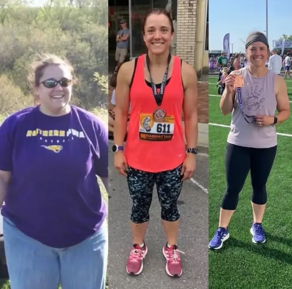 Woman before / after weight loss