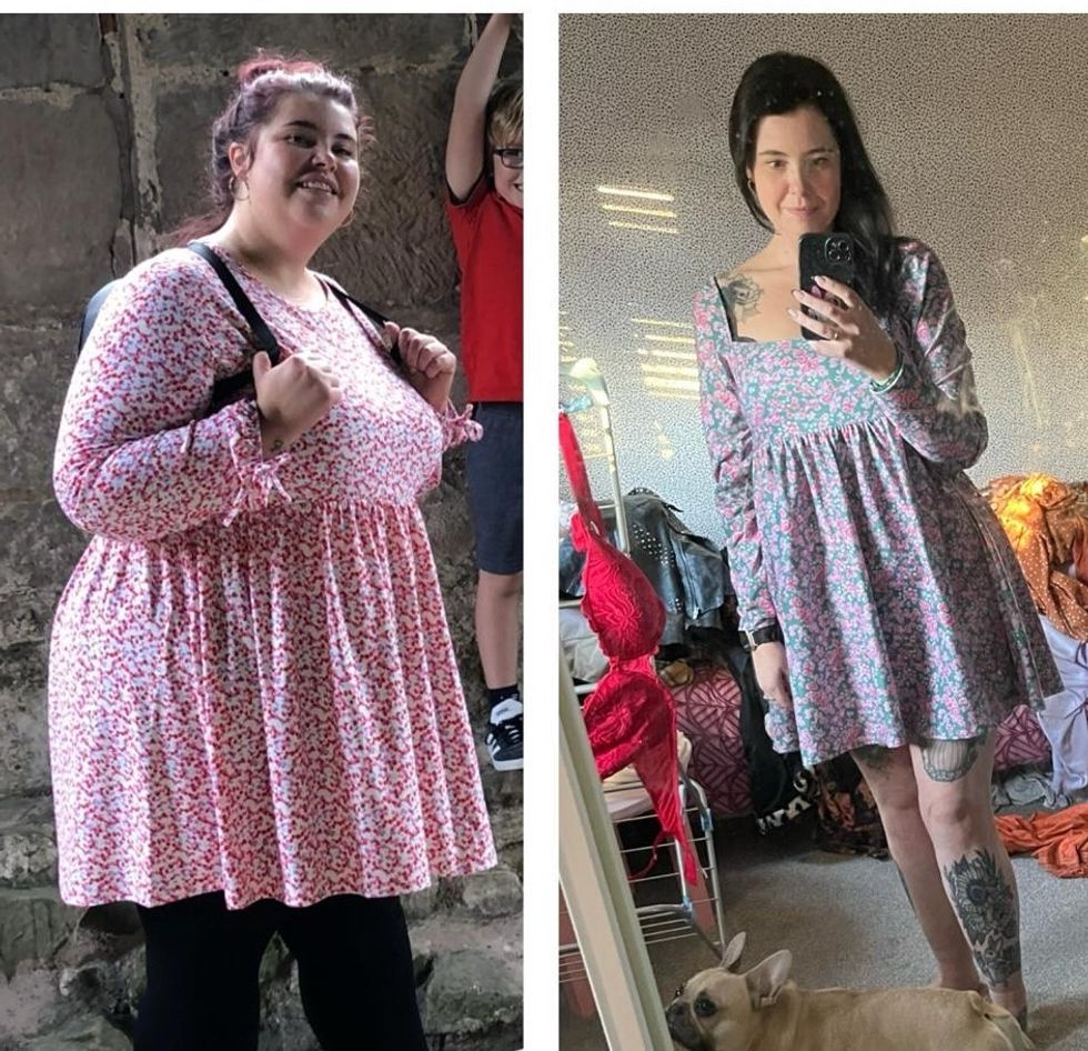Woman before and after weight loss