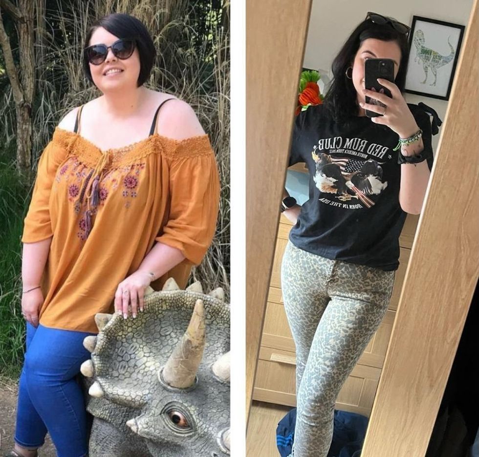 Woman before and after weight loss