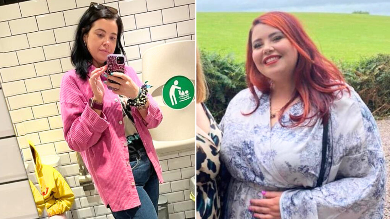 Woman before and after weight loss