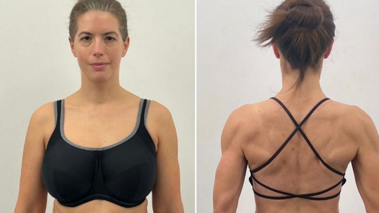 Woman before and after