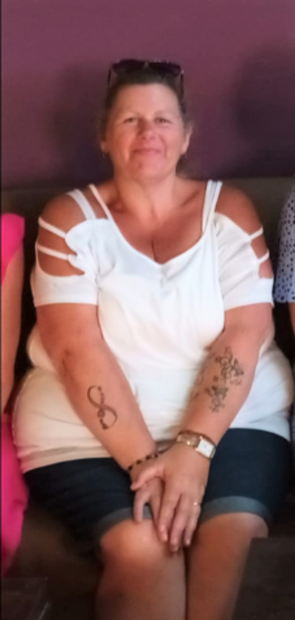 Woman before losing weight