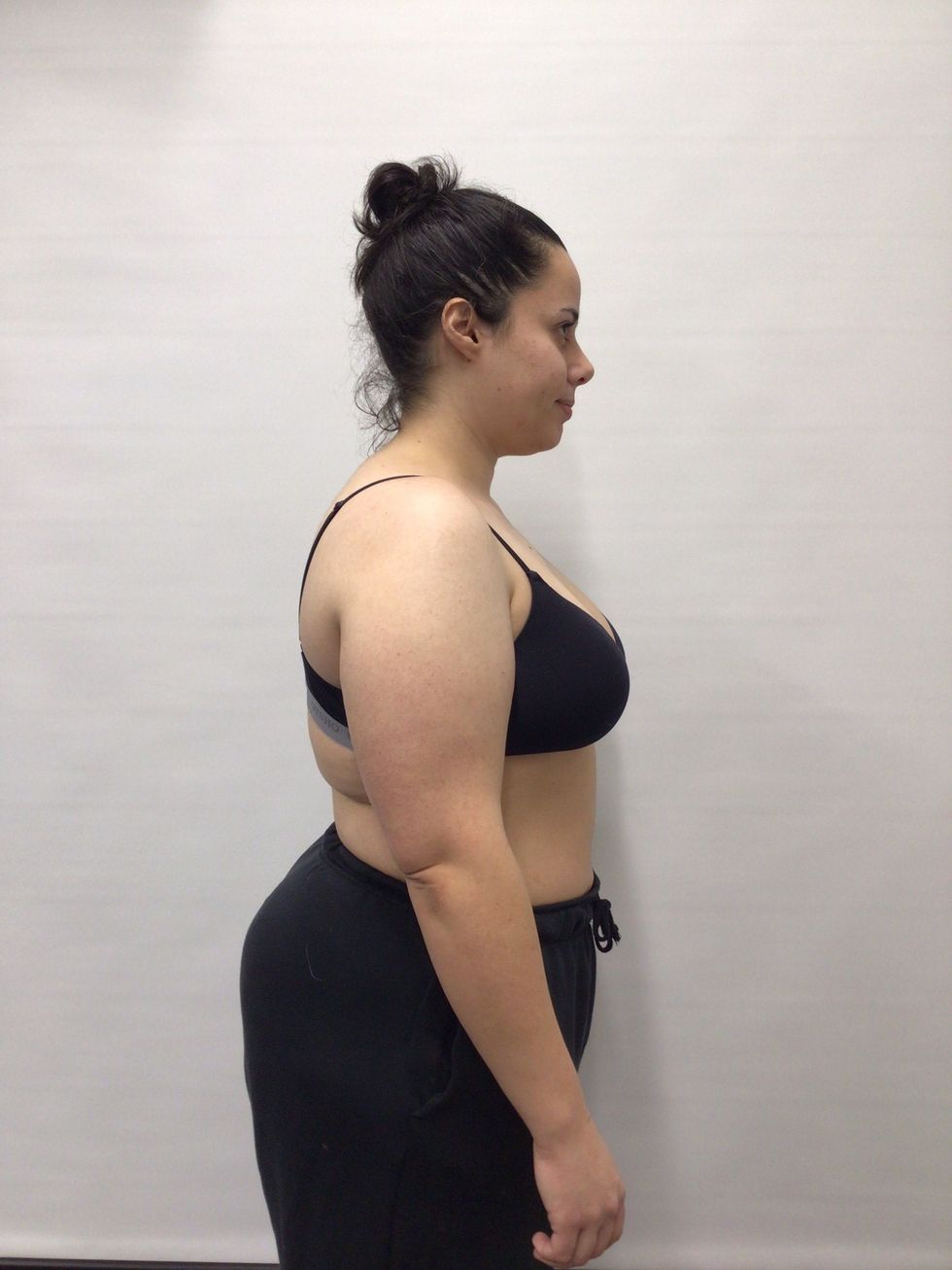 Woman before weight loss