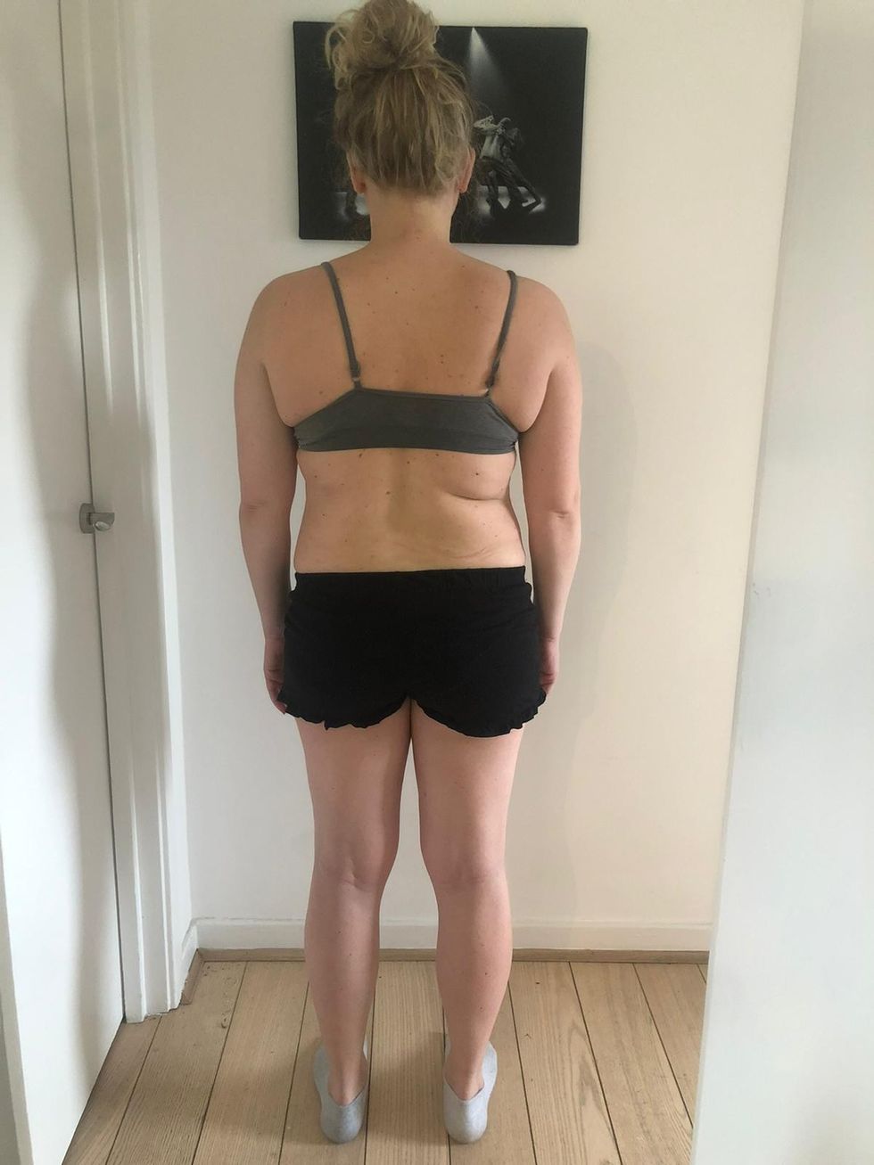 Woman before weight loss