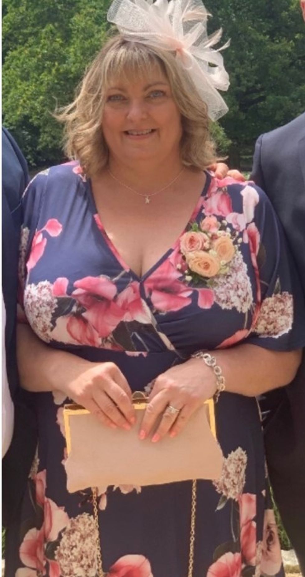 Woman before weight loss