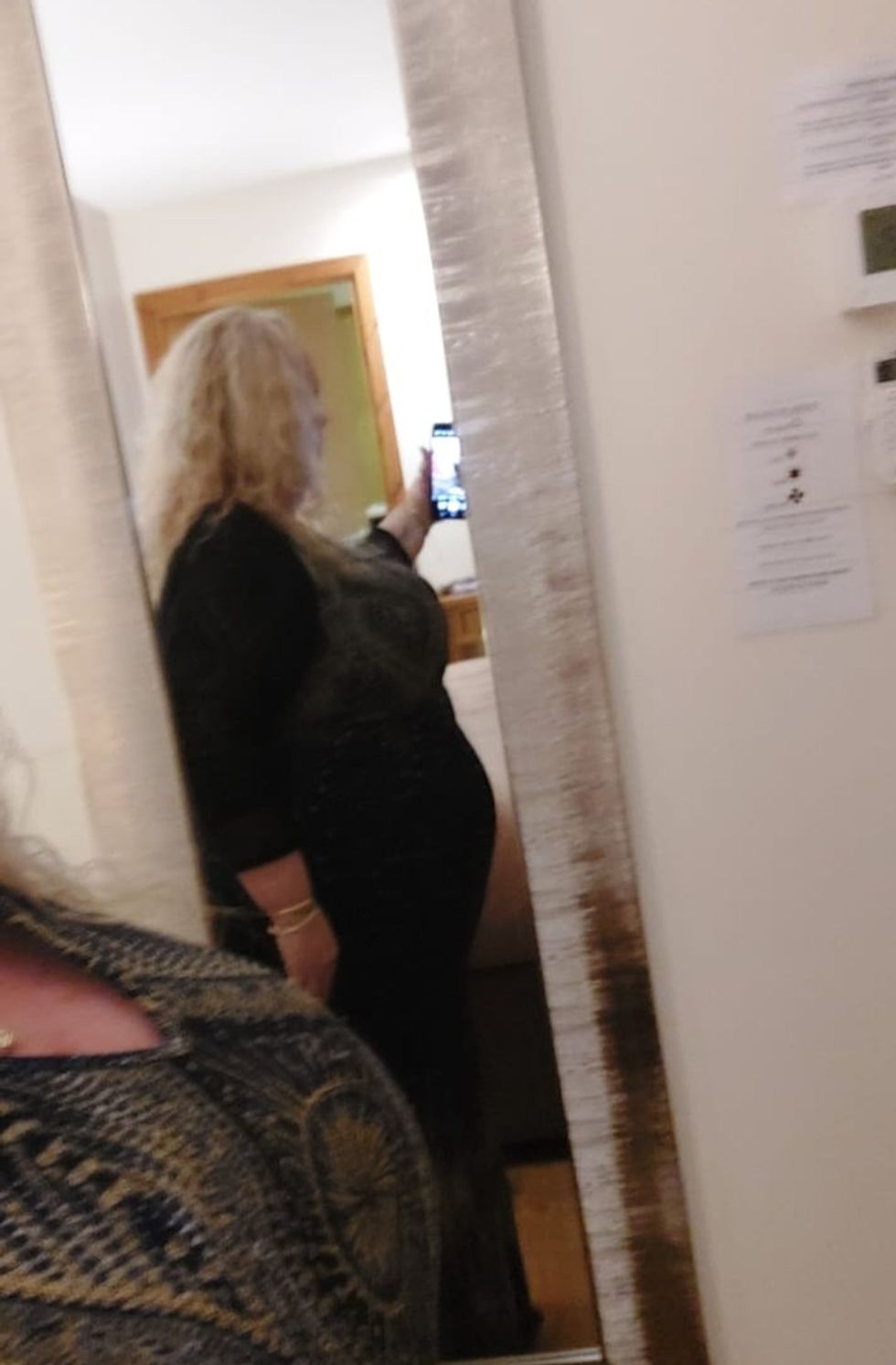 Woman before weight loss