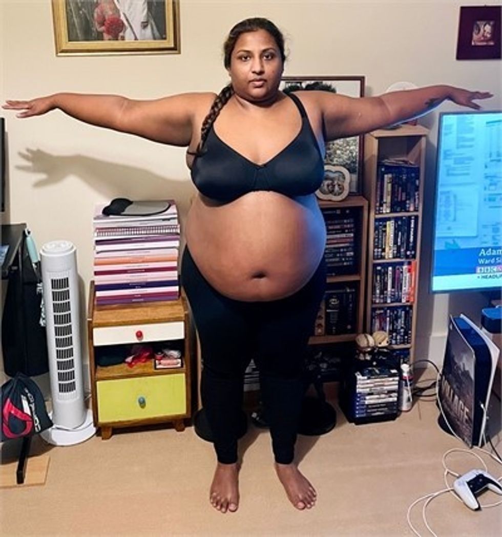 Woman before weight loss