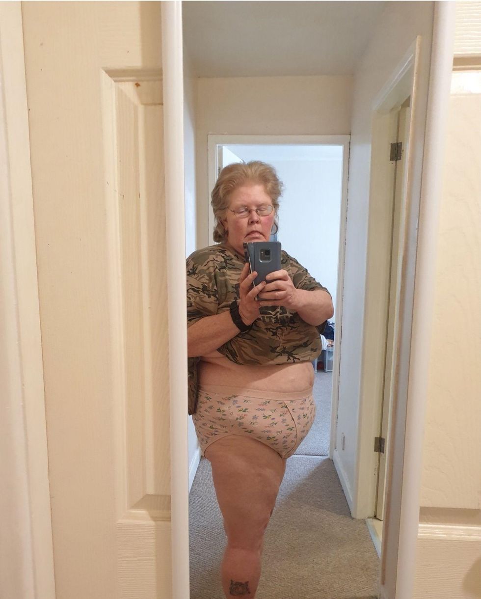 Woman before weight loss