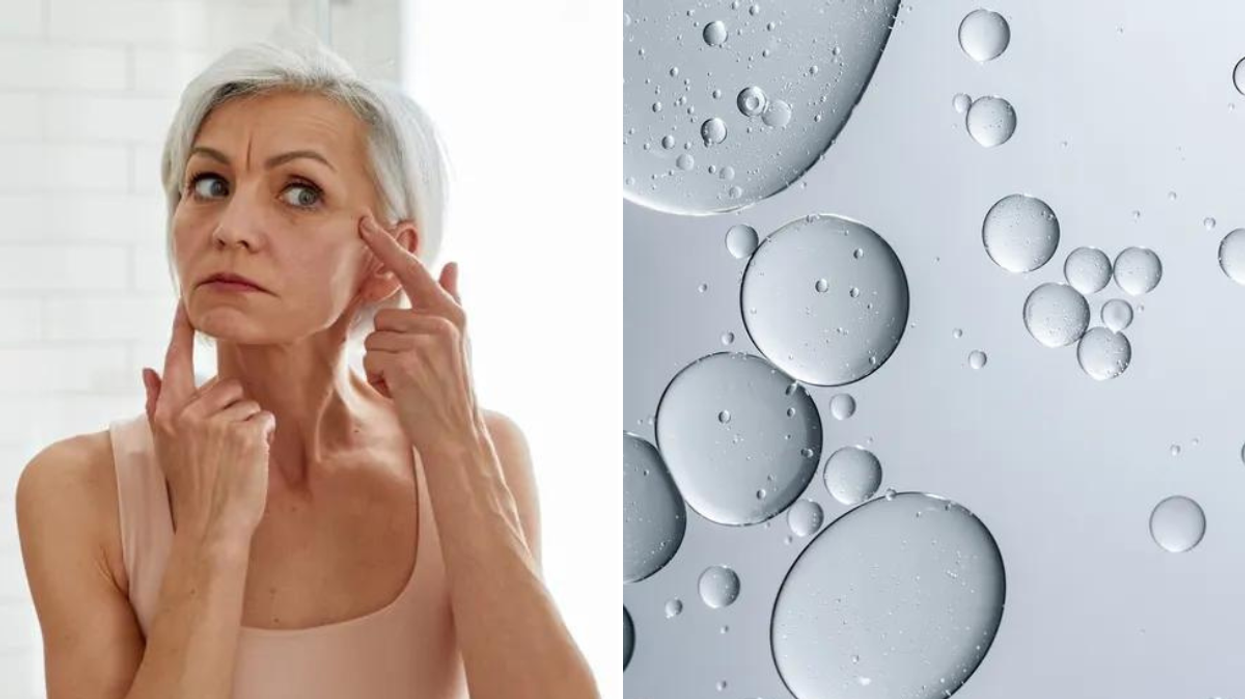 Woman doing skin care / hyaluronic acid