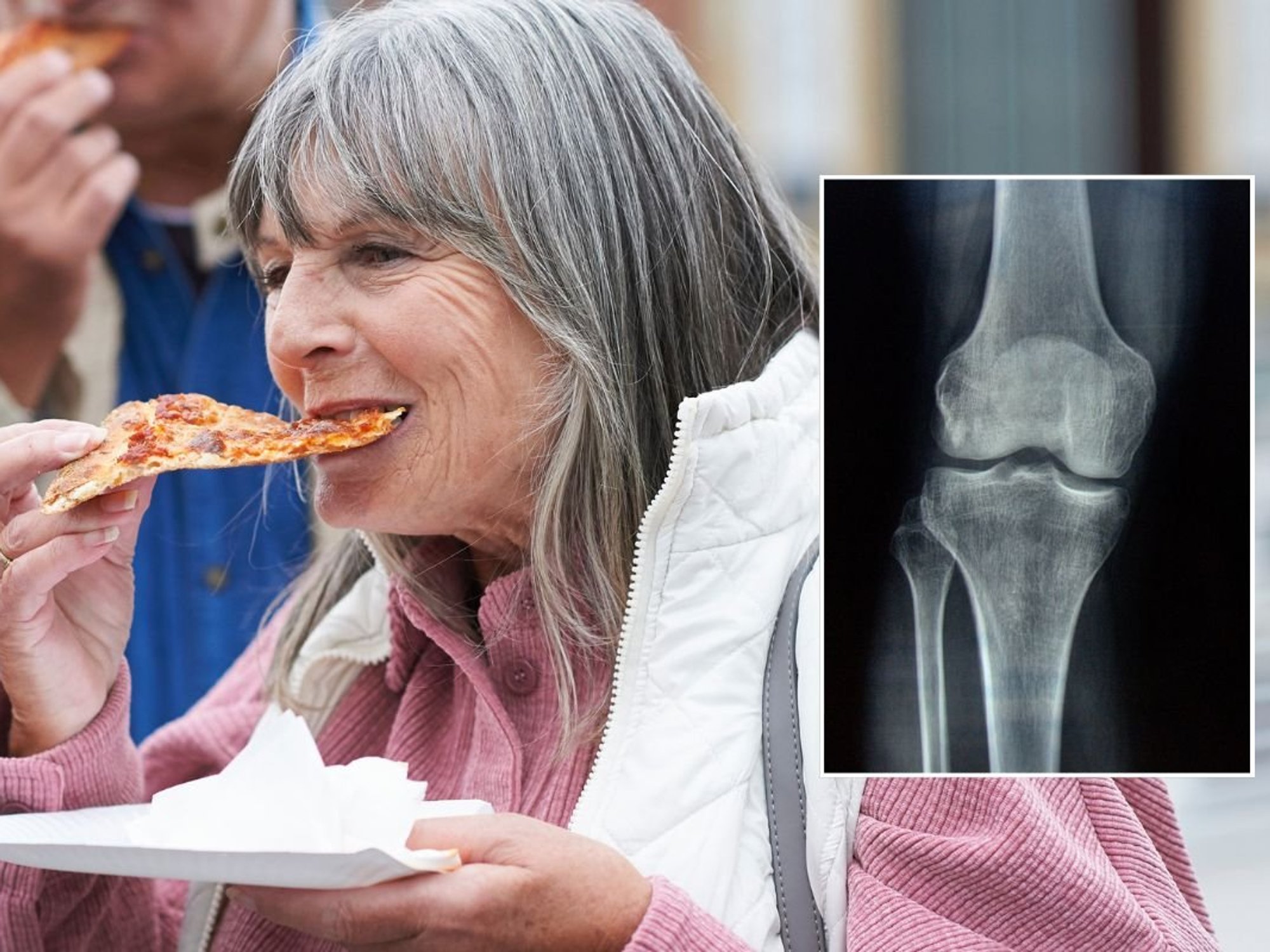 WOMAN EATING SLICE OF PIZZA AND X-RAY OF BONE