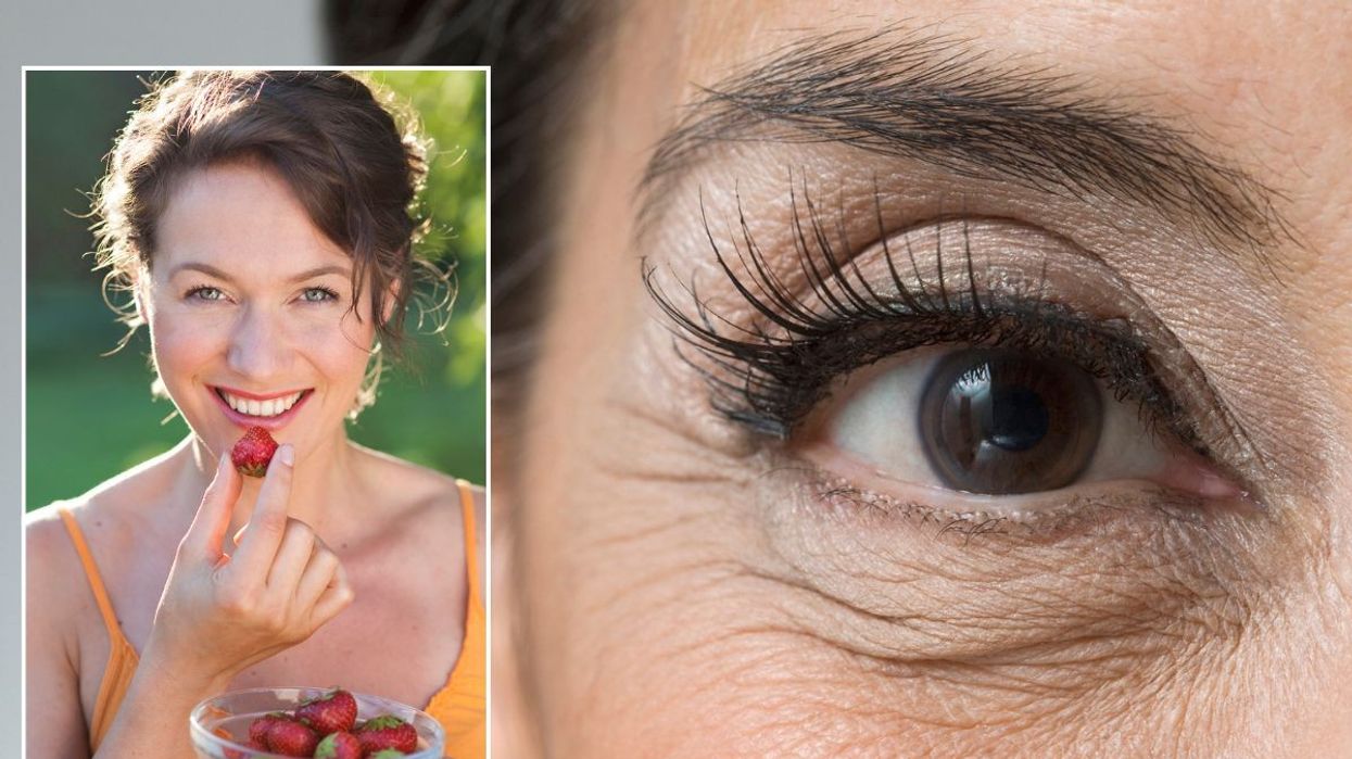 Woman eating strawberries / Close-up under-eye area