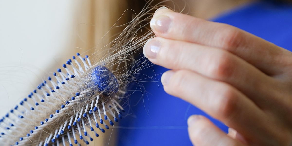 NextImg:Why is my hair falling out? Experts reveal underlying causes behind women's hair loss