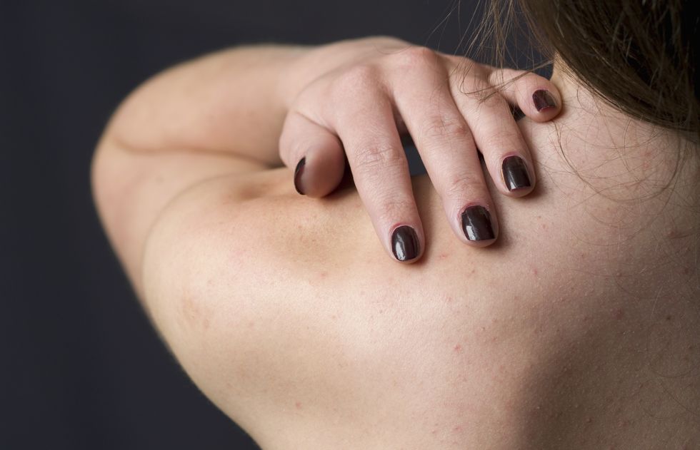 woman feeling lump on neck