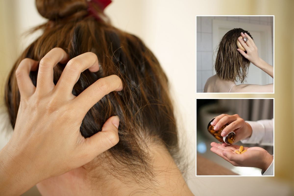Woman itching her scalp / Woman massaging oil into her hair / Pouring supplements into hand