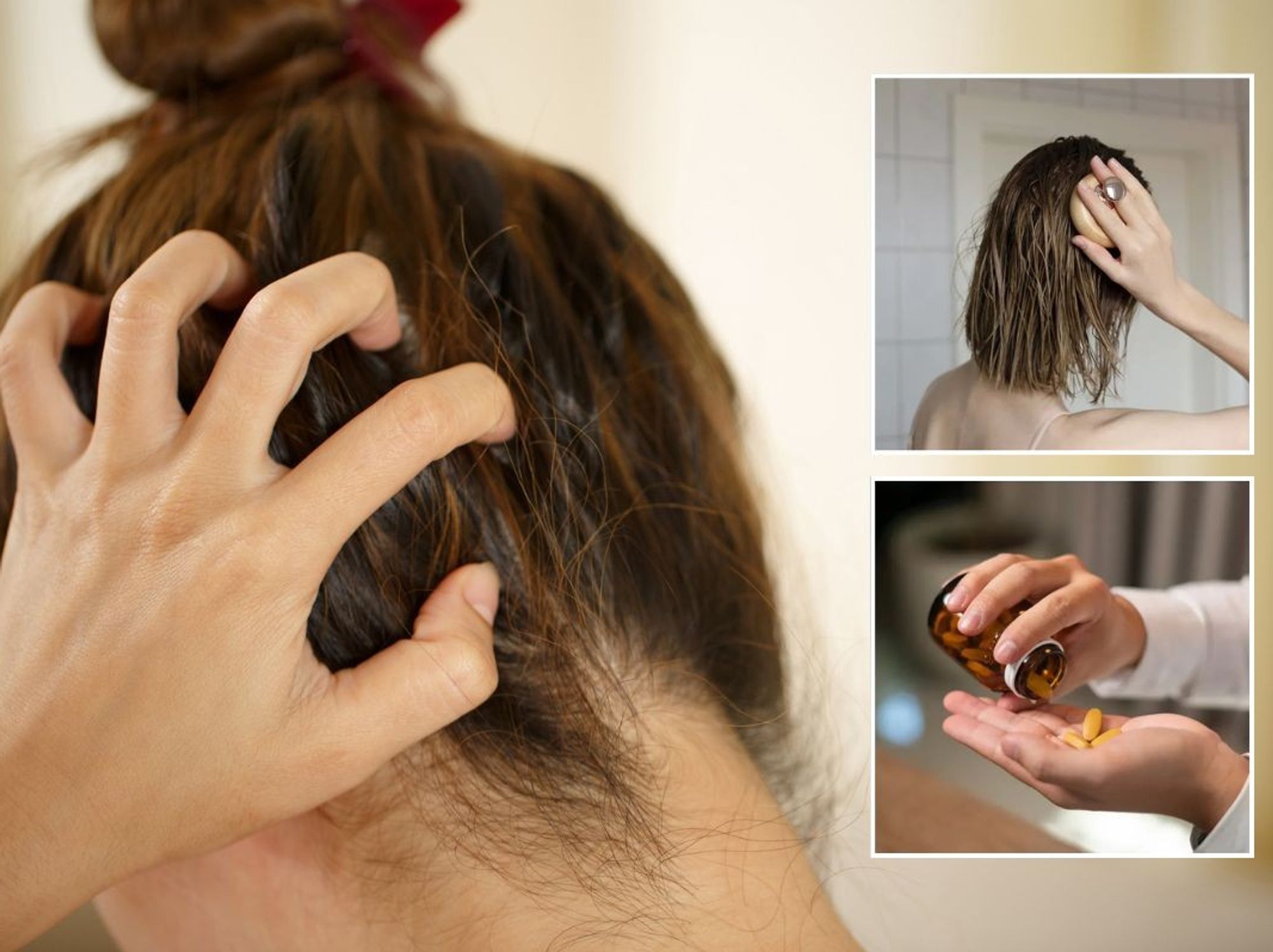 Woman itching her scalp / Woman massaging oil into her hair / Pouring supplements into hand