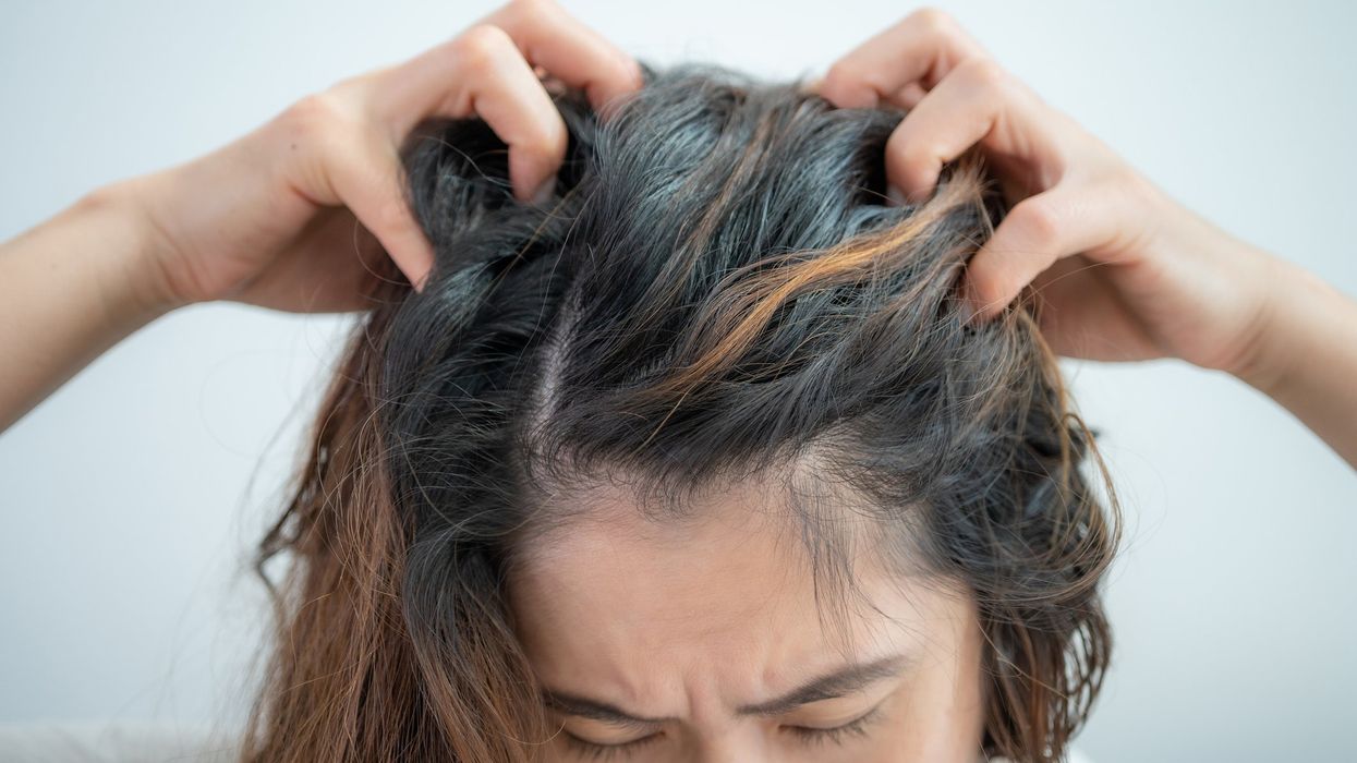 Woman itching her scalp