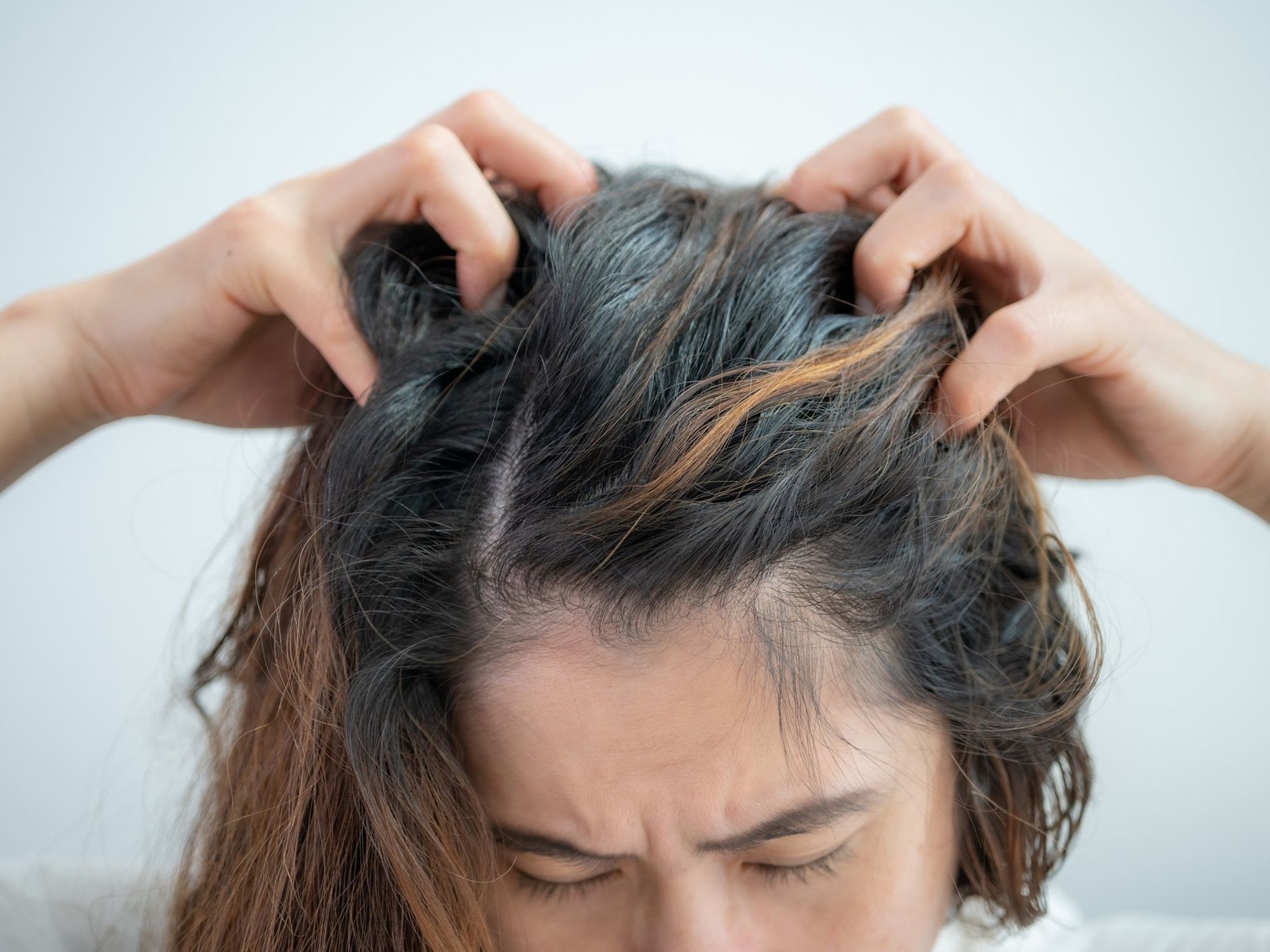 Woman itching her scalp