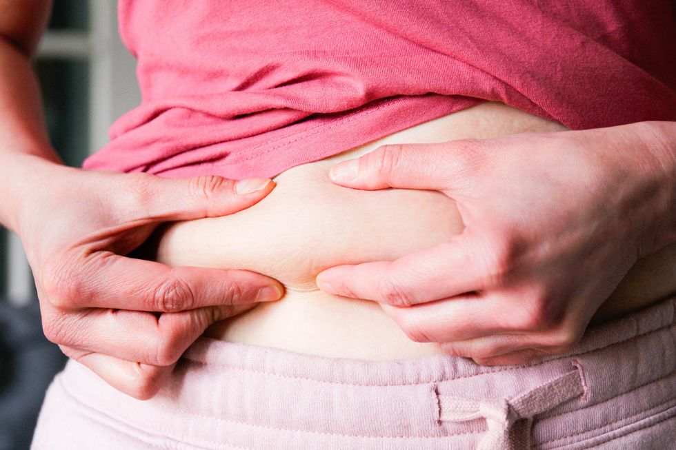 WOMAN PINCHING FAT
