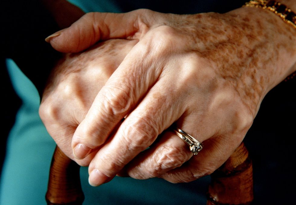 woman's hands with age spots