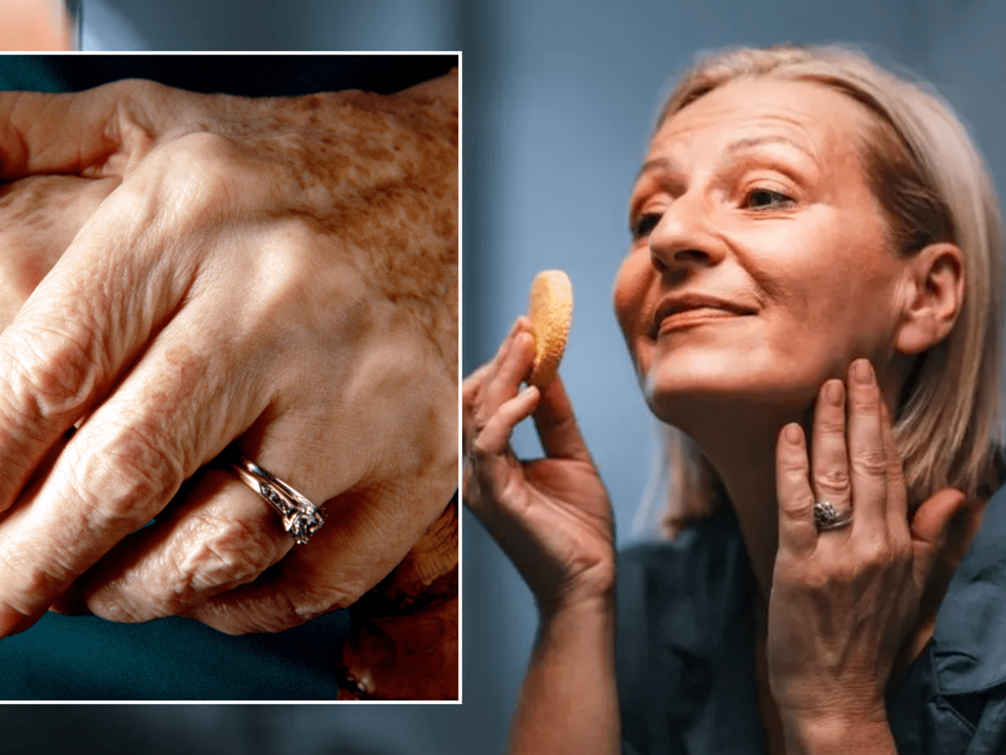 woman's hands with age spots