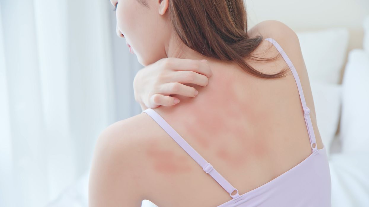 Woman scratching back