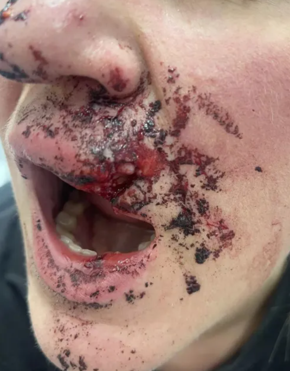 Woman suffers injuries after a brick is thrown at her