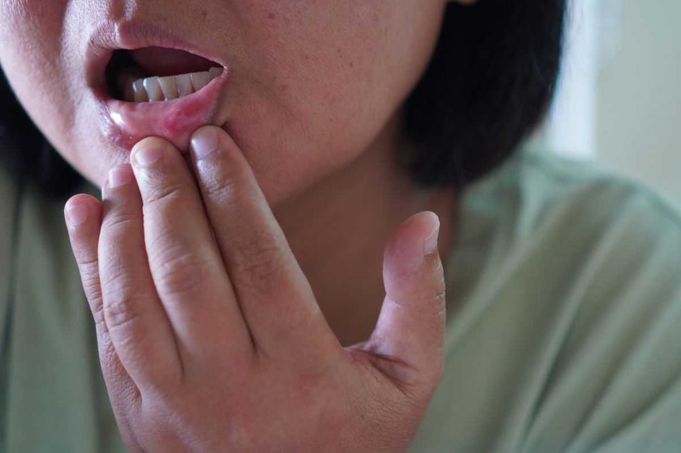 woman touching sore lips
