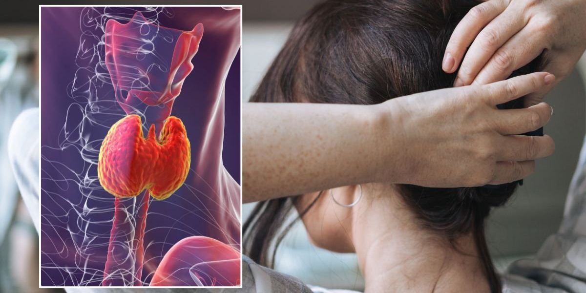 Thinning hair? Doctor warns 5 eating habits could be to blame for sudden changes in thickness Thinning hair? Doctor warns 5 eating habits could be to blame for sudden changes in thickness