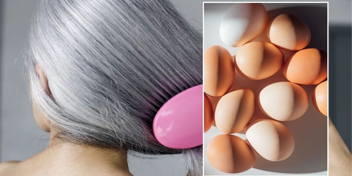 NextImg:Expert shares dietary hacks that may 'restore natural pigmentation in some cases'