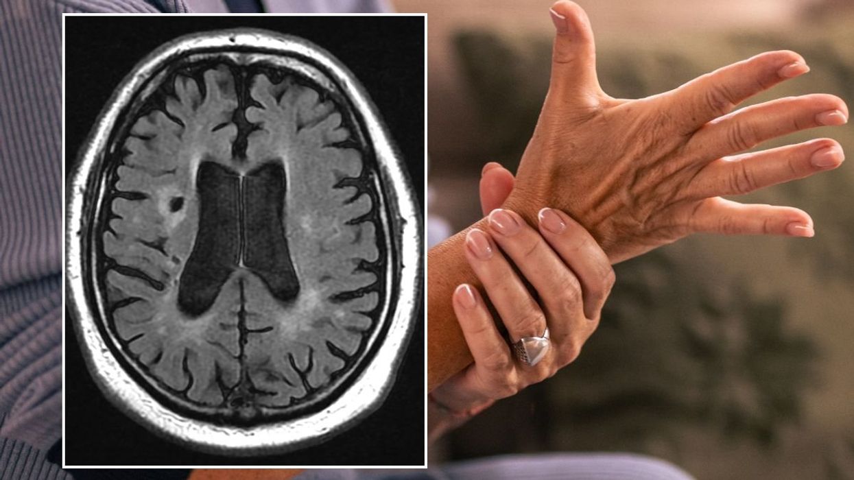 WOMEN HOLDING HAND AND BRAIN SCAN