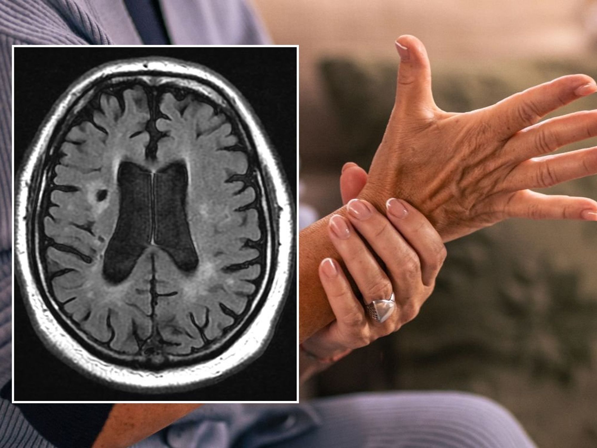 WOMEN HOLDING HAND AND BRAIN SCAN