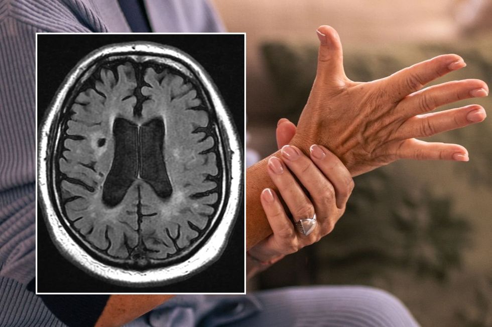 WOMEN HOLDING HAND AND BRAIN SCAN