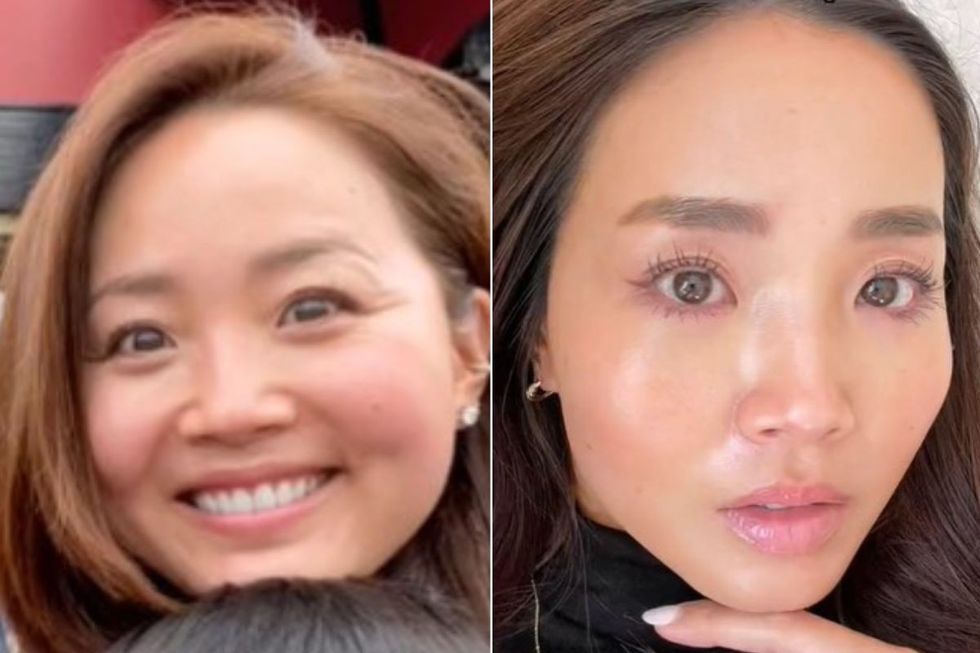 yuri before and after